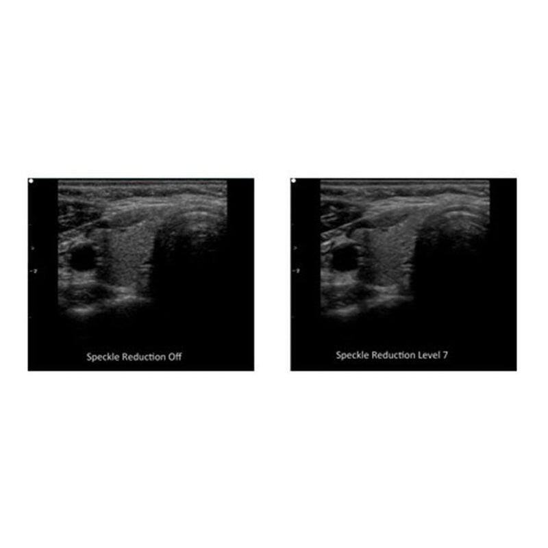 Edan Portable Diagnostic Ultrasound System-Edan-HeartWell Medical