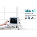 Edan Digital Ultrasound Diagnostic System-Edan-HeartWell Medical