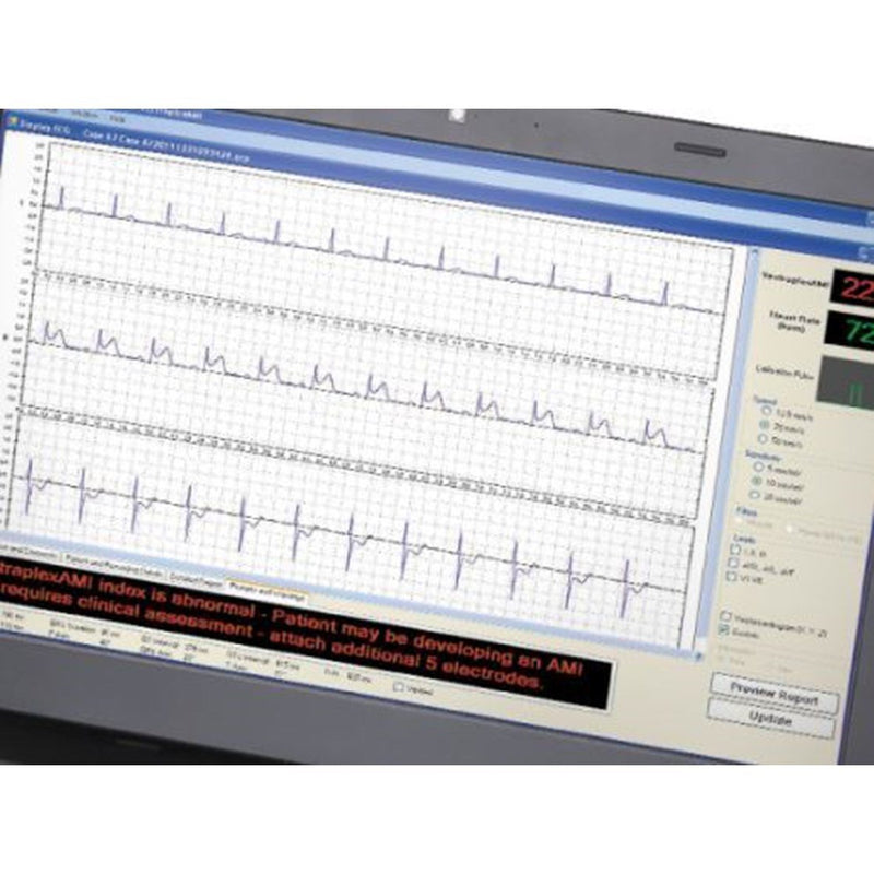 Vectracor Vectraplex ECG-Vectracor-HeartWell Medical
