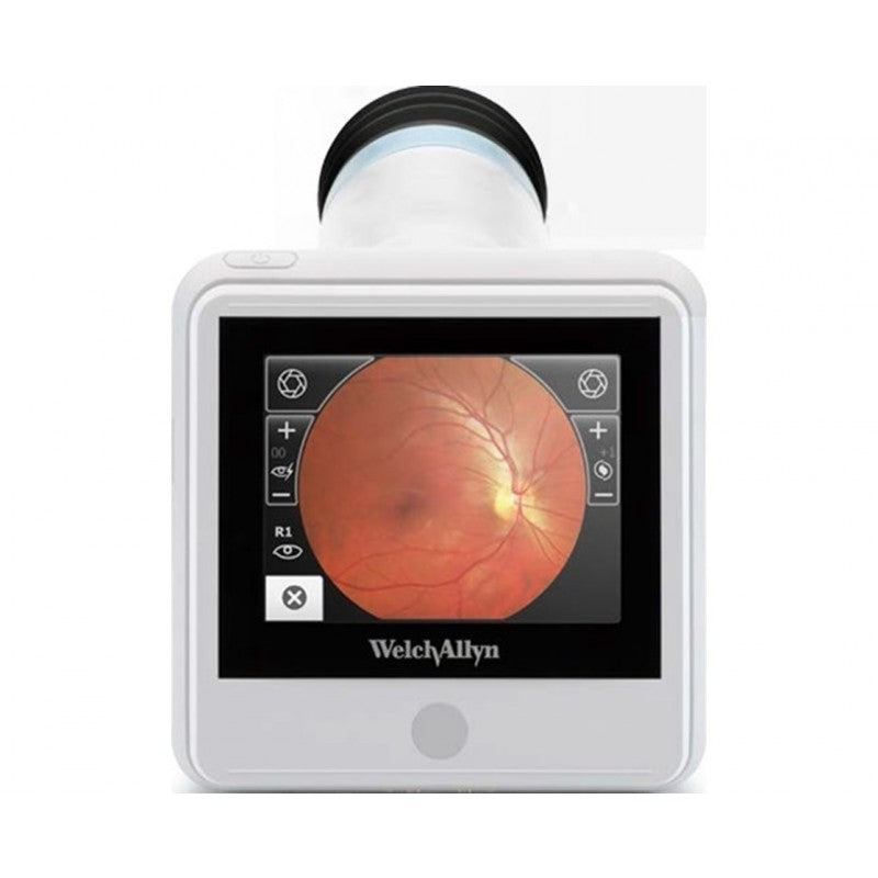 Hill-Rom RetinaVue 100 Imager Non-Mydriatic Retinal Camera-Hill-Rom-HeartWell Medical