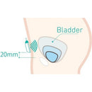 DFree Wearable Device That Helps Manage Incontinence-DFree-HeartWell Medical