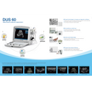 Edan Digital Ultrasound Diagnostic System-Edan-HeartWell Medical