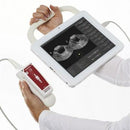 Vitacon VitaScan PD Bladder Scanner-Vitacon-HeartWell Medical