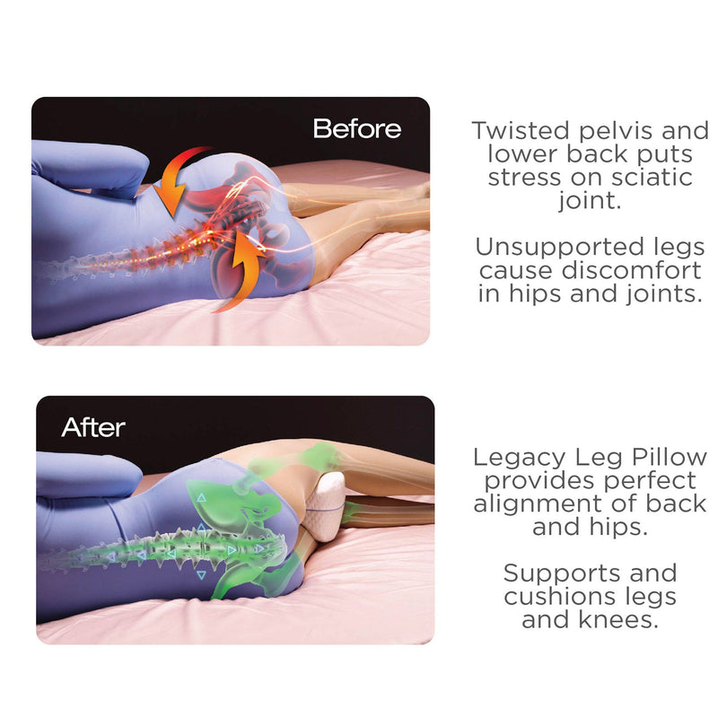 Contour Health Legacy Leg Pillow-Contour Health-HeartWell Medical