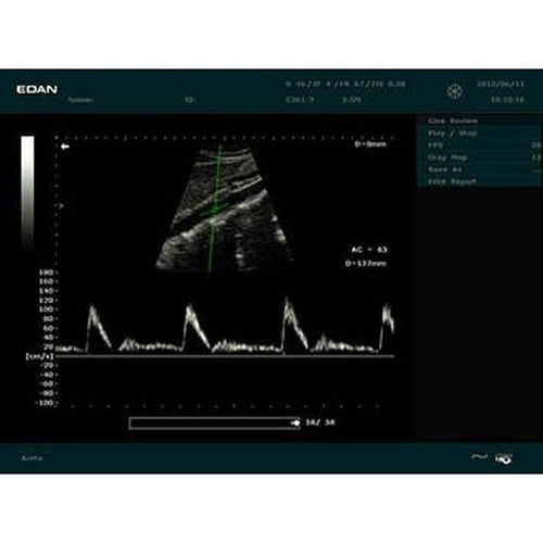 Edan Digital Ultrasound Diagnostic System-Edan-HeartWell Medical