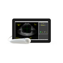 Interson ViewBladder 10 Tablet Bladder Scanner-Interson-HeartWell Medical