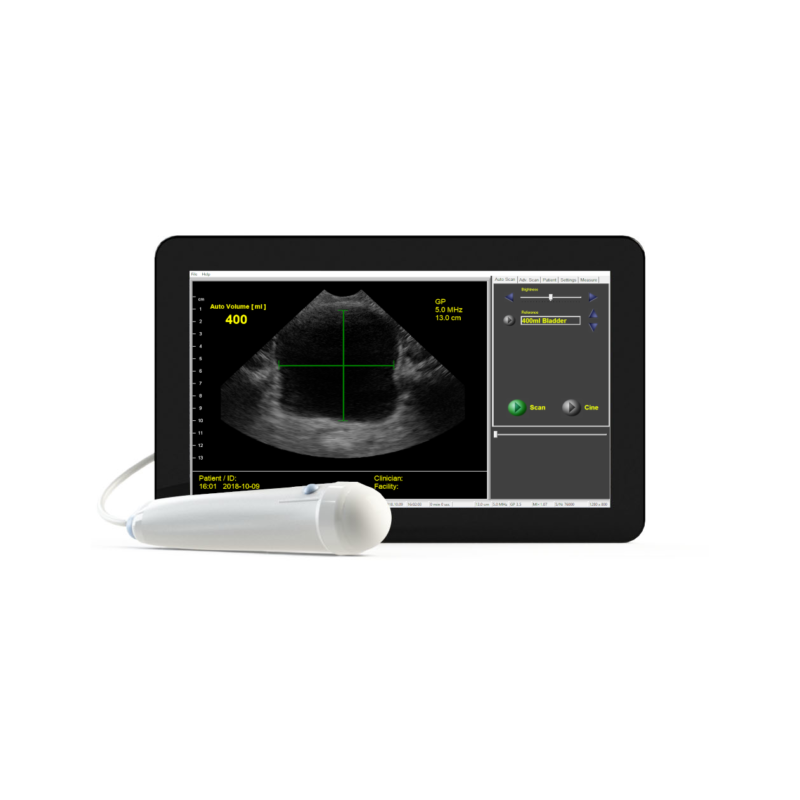 Interson ViewBladder 10 Tablet Bladder Scanner-Interson-HeartWell Medical
