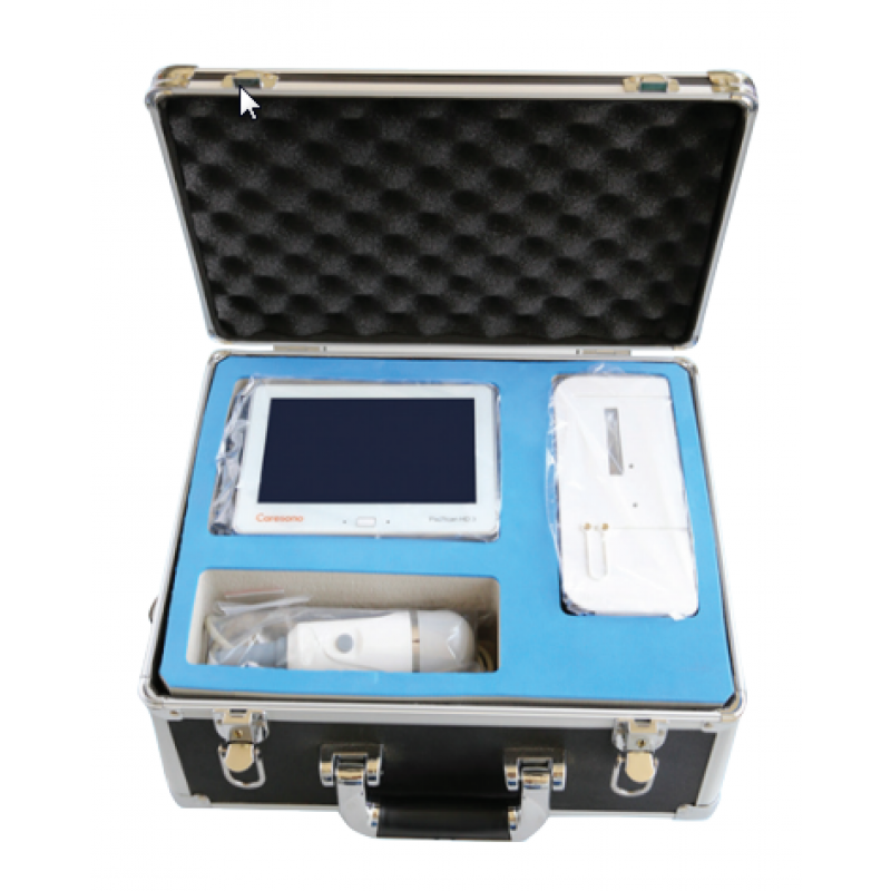 Caresono PadScan HD3 Bladder Scanner-Caresono-HeartWell Medical